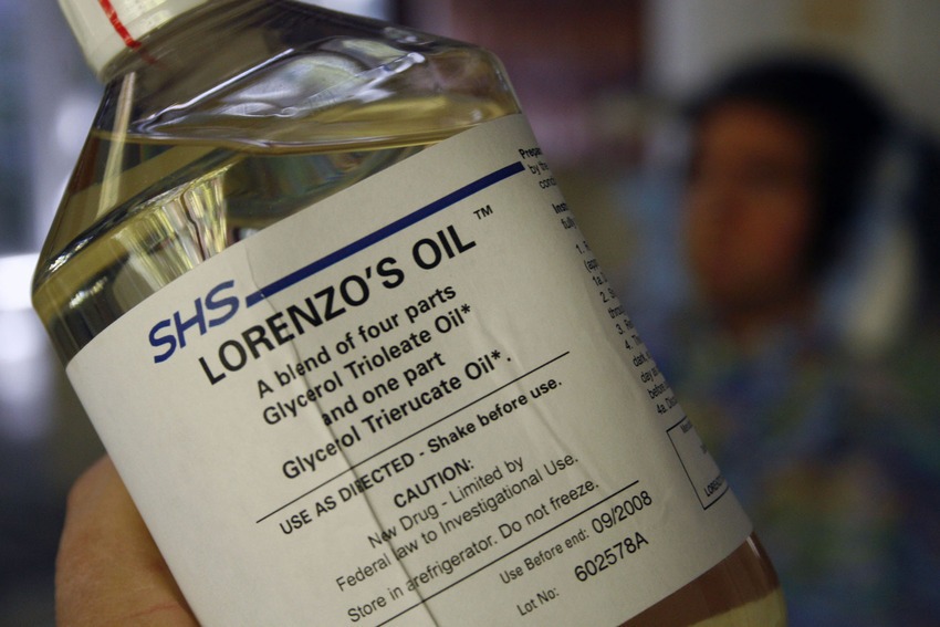 lorenzos-oil